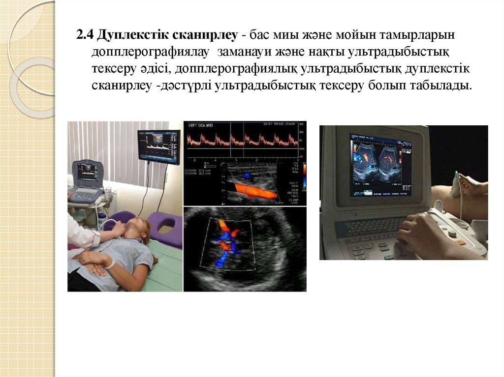 Проверка сосудов. Ультразвуковая допплерография сосудов головного мозга. Исследования головного мозга ультразвуковая допплерография. Допплеровское сканирование кровеносных сосудов. УЗДГ допплер сосудов головы.