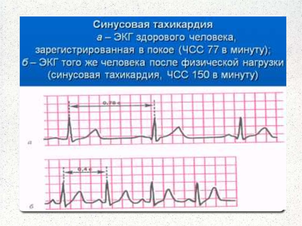 Методика снятия экг