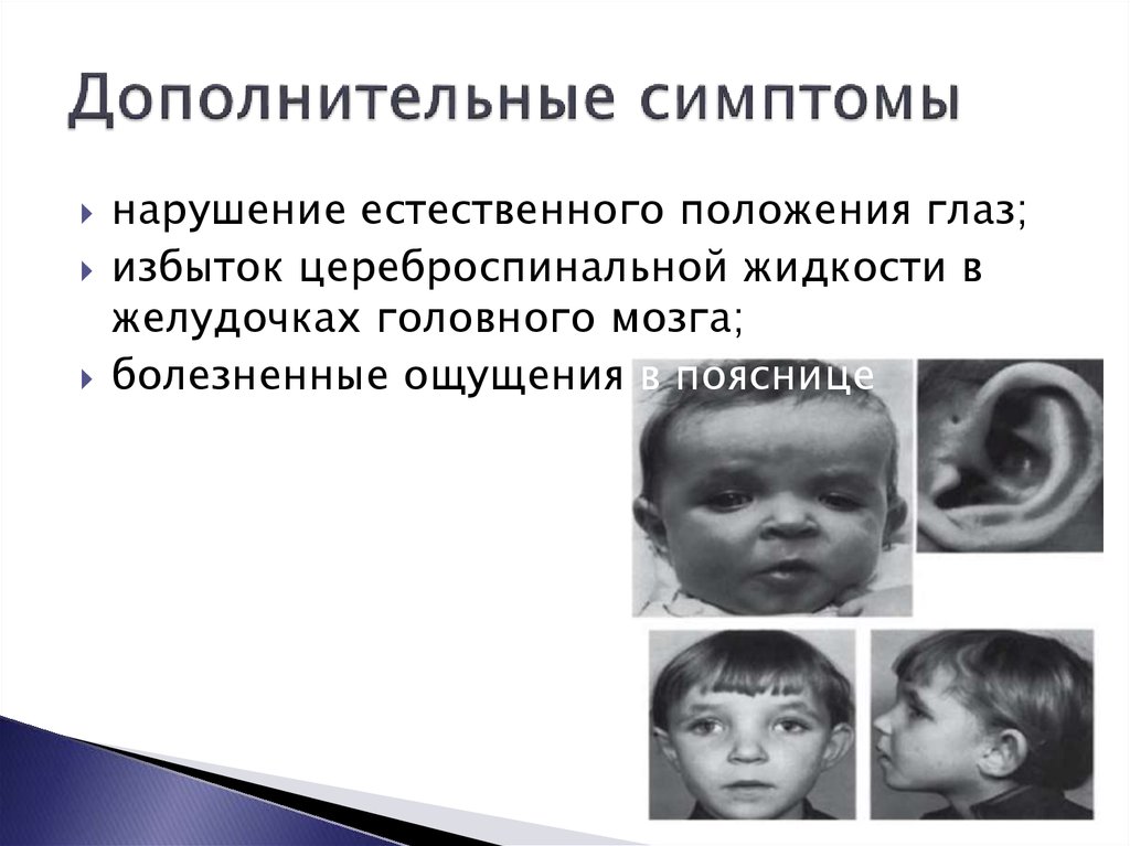 Дополнительные симптомы