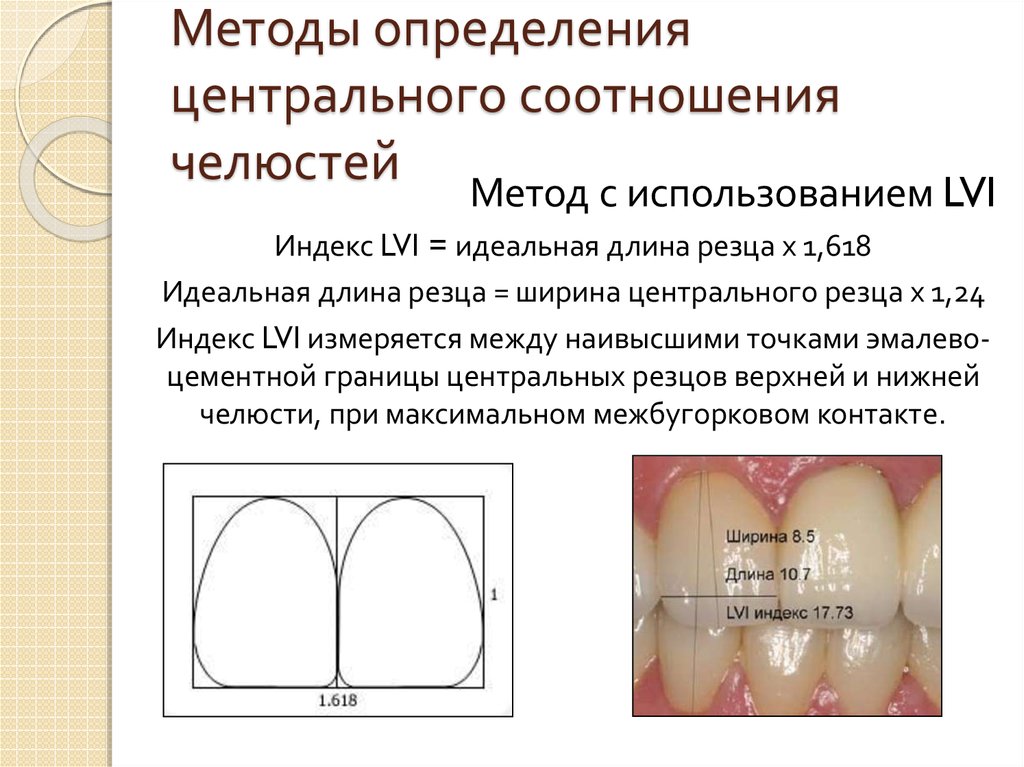 Измерение соотношения. Центральное соотношение зубов методика определения. Центральное соотношение челюстей методы. Методика определения центрального соотношения.