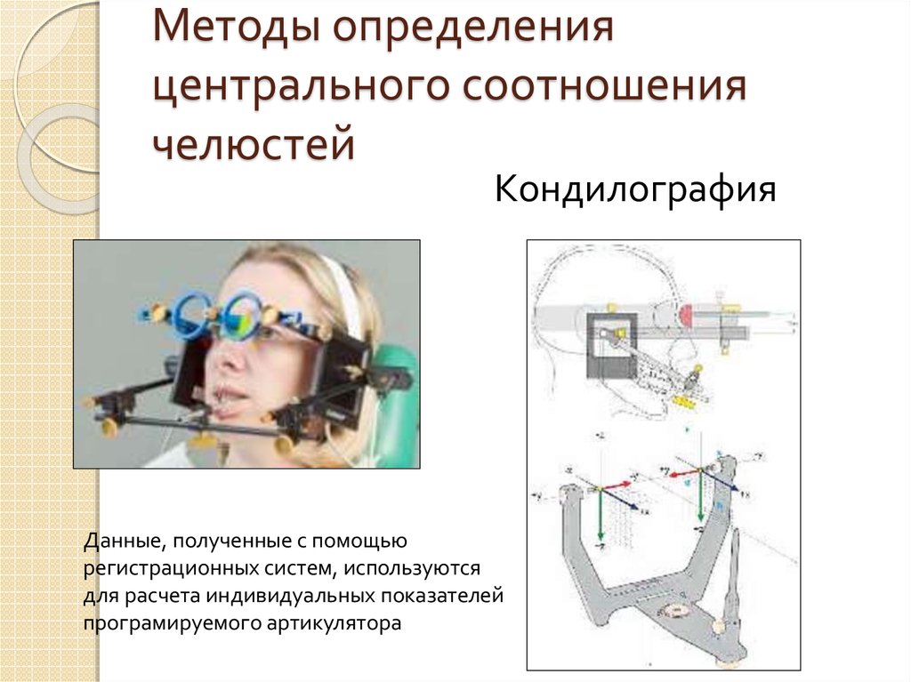 Метод определен. Методы определения центрального соотношения челюстей. Методика определения центрального соотношения челюстей. Кондилография метод определения центрального соотношения. Анатомо функциональный метод определения центрального соотношения.