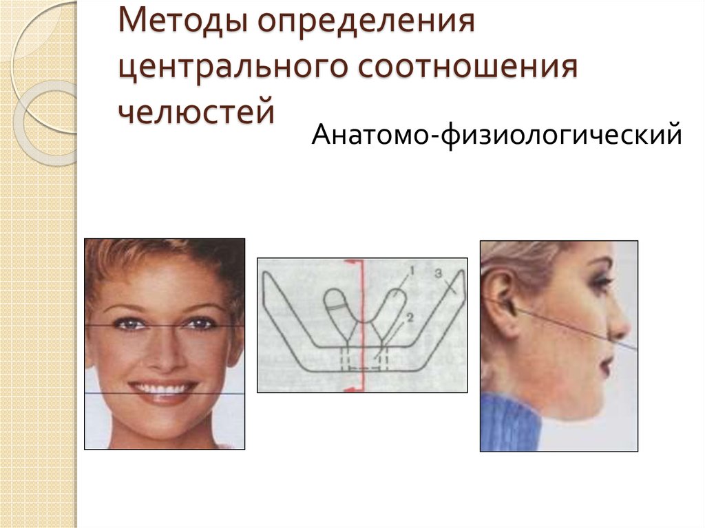 Методы определения центрального соотношения челюстей презентация