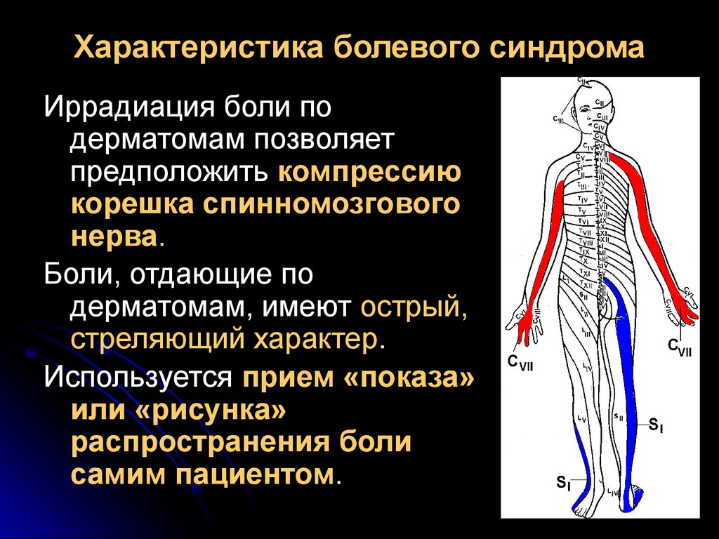 Иррадиация поясницы