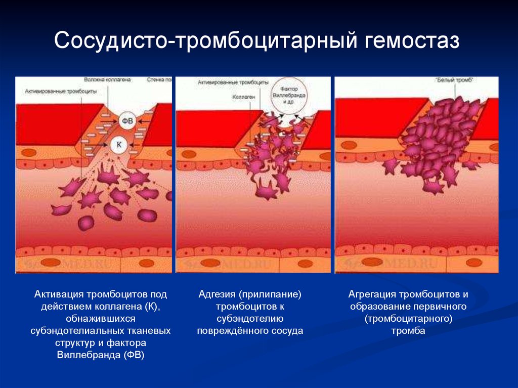 Схема образования кровяного сгустка