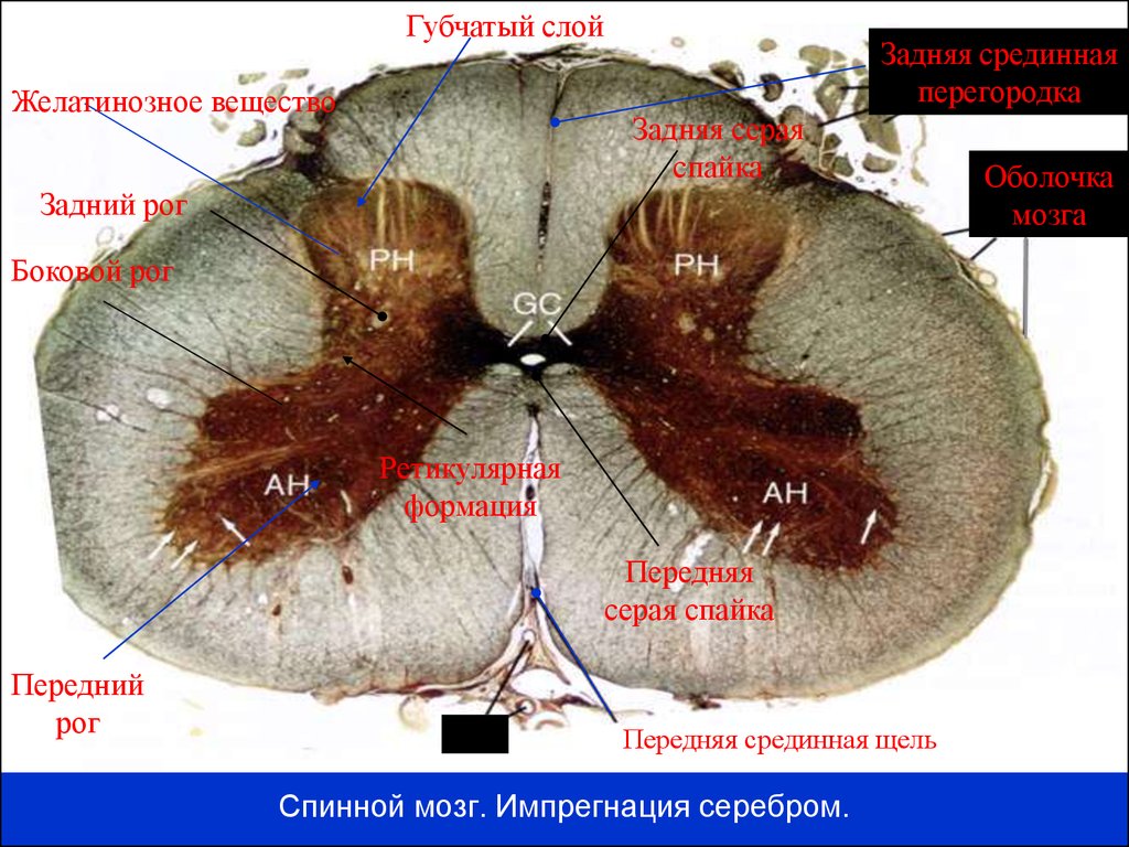 Передний рог мозга. Боковые рога спинного мозга препарат. Препарат спинной мозг спайки. Спинной мозг импрегнация серебром. Задняя спайка спинного мозга.