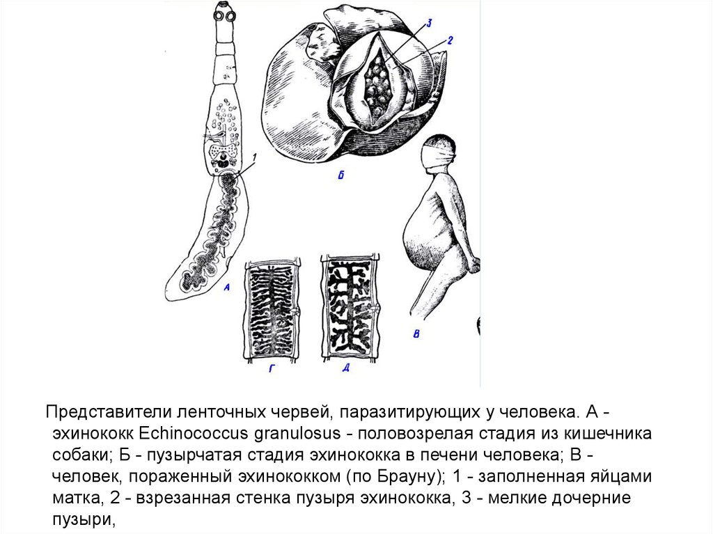 Цифрой обозначено на рисунке яйцо эхинококка. Ленточные черви эхинококк. Пузырчатая стадия ленточных червей. Ленточный червь эхинококк. Финна эхинококка в человеке.