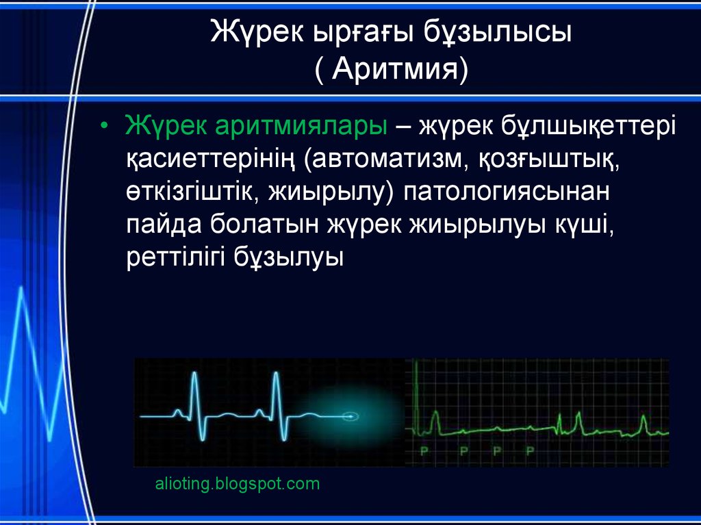 Сердечный ритм презентация