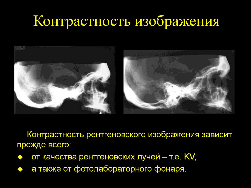 Контрастное изображение это