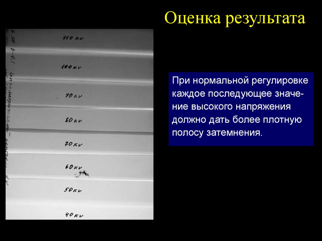 Контраст оценка. Нормальная контрастность фотоплёнки. Текст из затемнения.