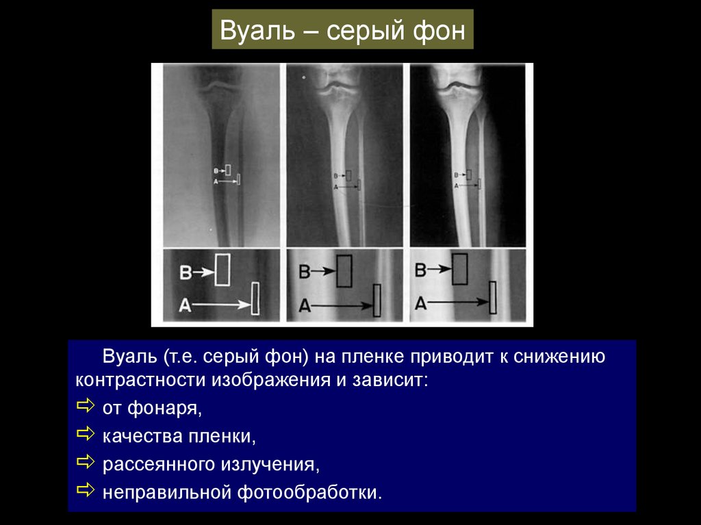 Методы контрастирования изображения