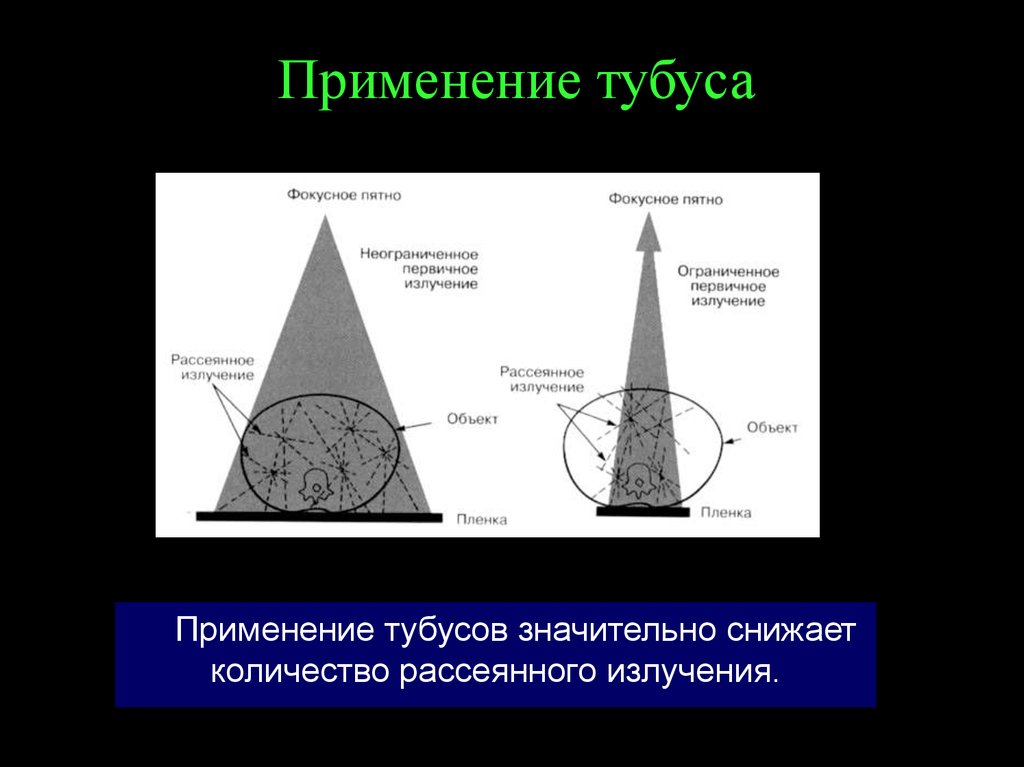 Нерезкость рентгеновского изображения