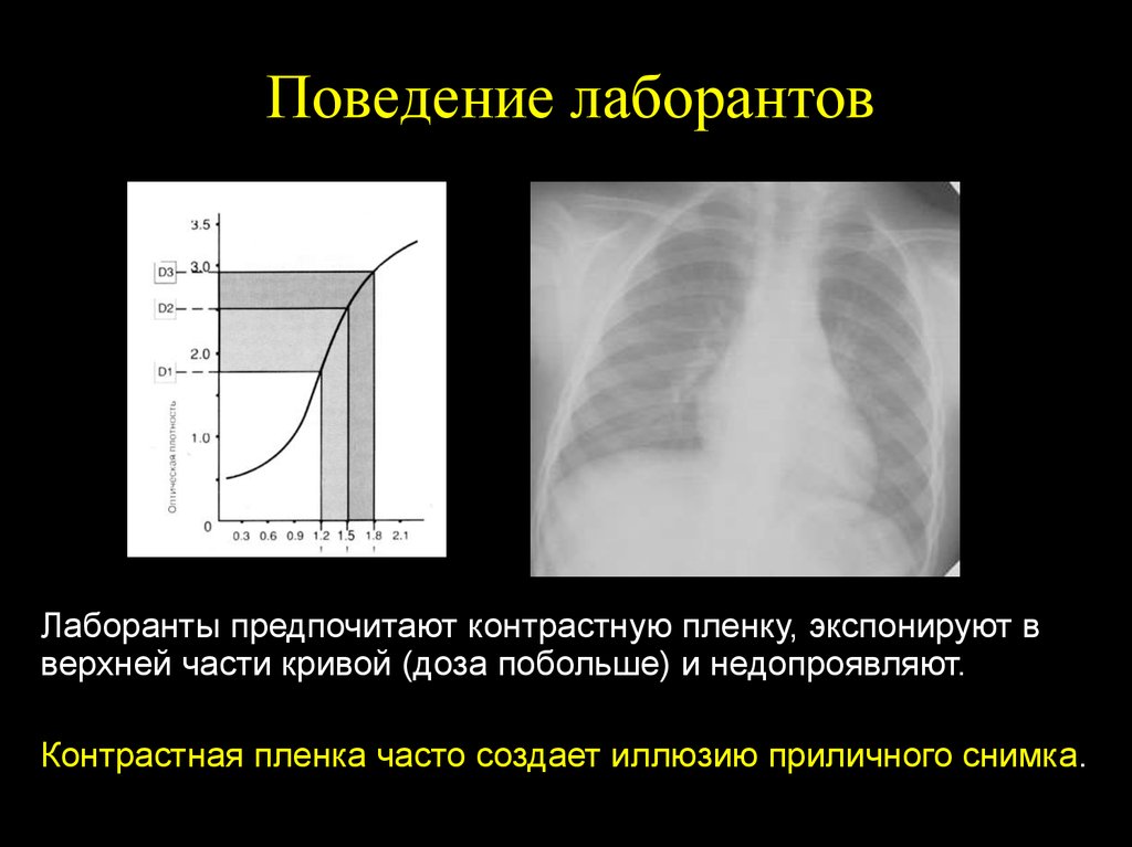 Части кривой. Контрастность фотопленки это. Контрастность рентгеновской пленки это. Контрастность изображения рентген. Контрастная пленка.