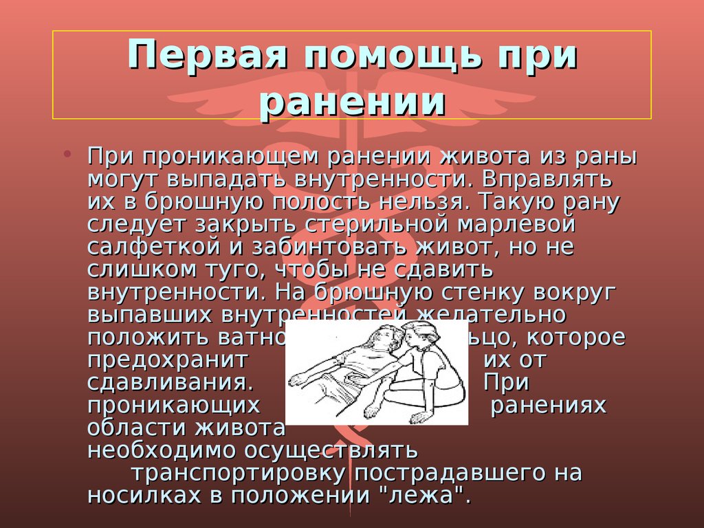 Первое мероприятие при ранении. Первая помощь при ранениях. Первая помощь при панение. Первач помощь при рпнении. Оказание первой помощи при ранении брюшной полости.