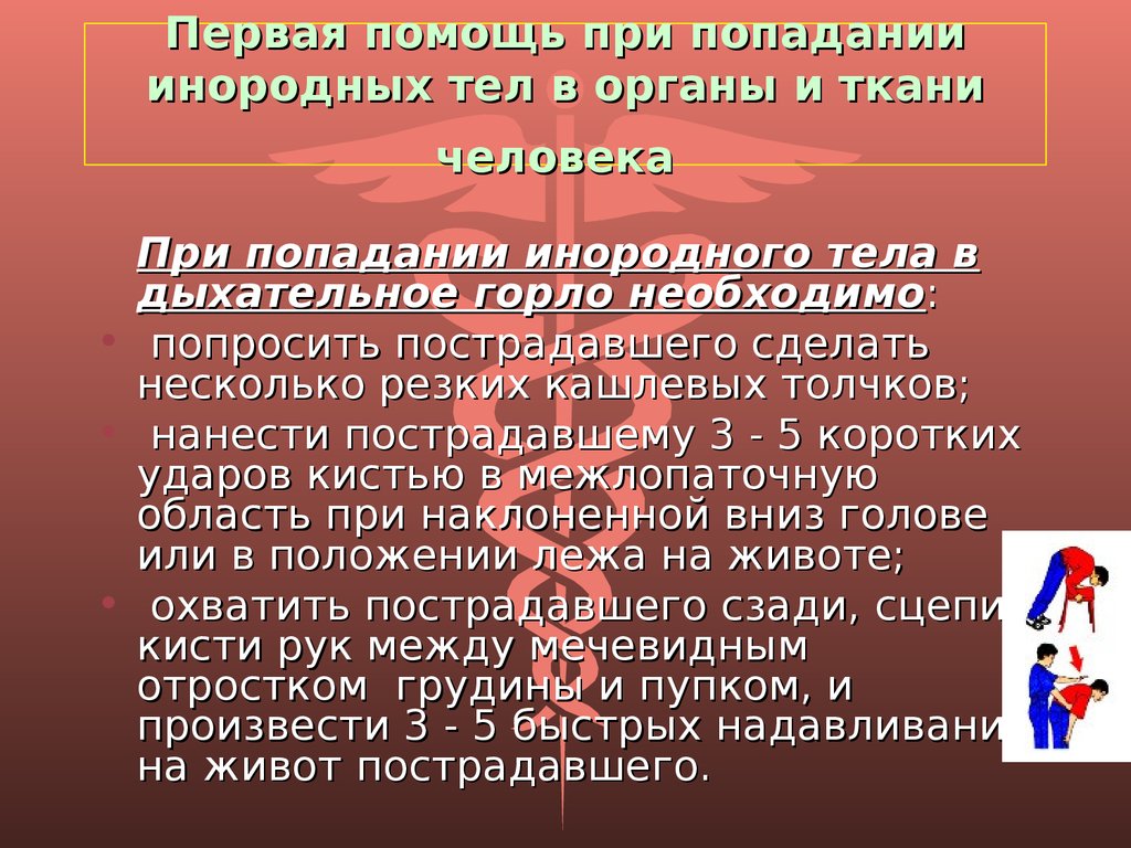 Оказание первой медицинской помощи при попадании инородных тел в дыхательные пути презентация