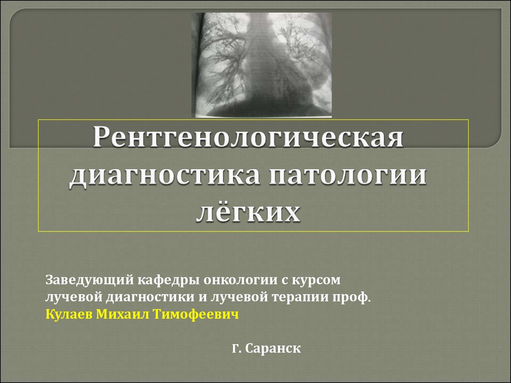 Рентгенологическая картина гигантоклеточной опухоли характеризуется разновидностями