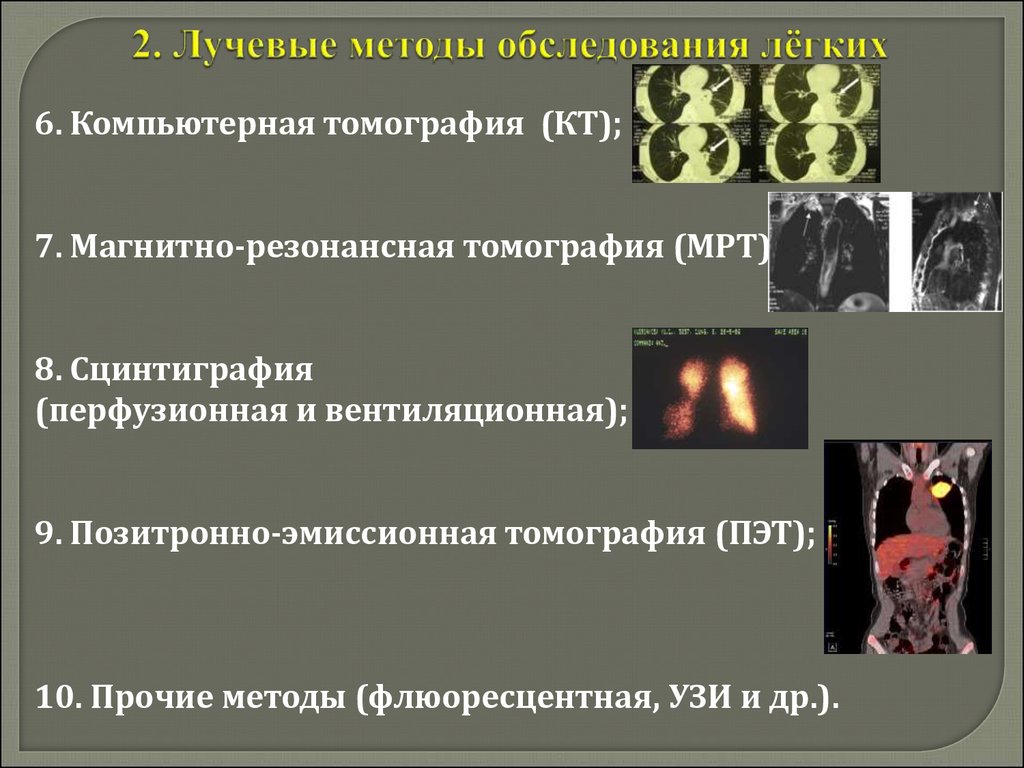 Лучевые методы. Методы лучевой диагностики легких. Лучевые методы исследования легких. Методы лучевого обследования. Лучевая исследование легких виды.