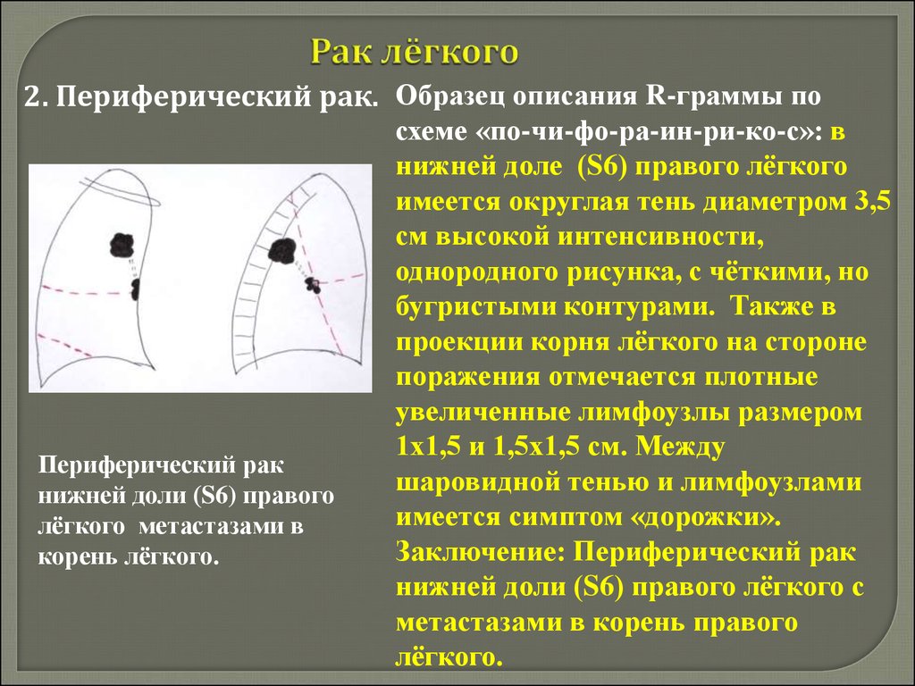 Рак правого. Периферическое образование нижней доли правого легкого. Периферическое образование нижней доли левого легкого. Периферическое образование в легких что это. Периферический c-r правого легкого.