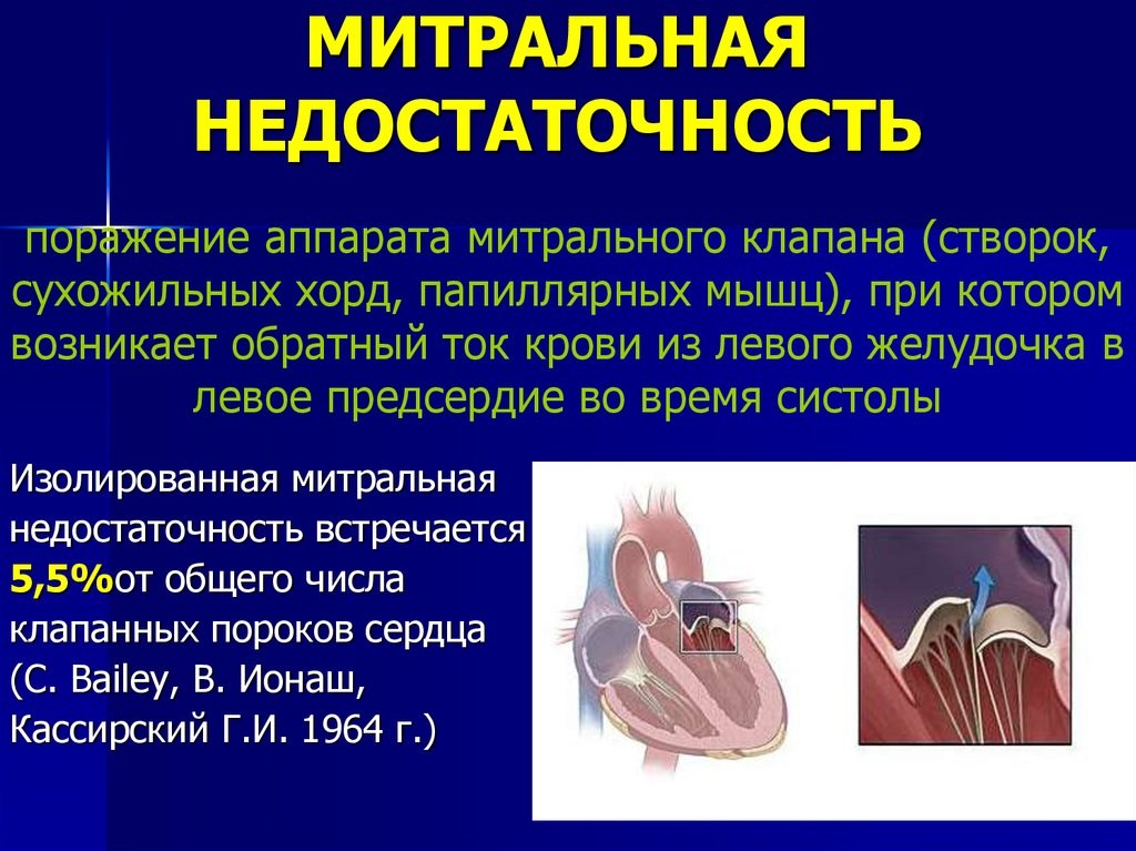 Поражение митрального клапана. Физиология недостаточность митрального клапана. Митральный клапан функции. Пороки сердца митральная недостаточность. Приобретенный порок сердца митральная недостаточность.