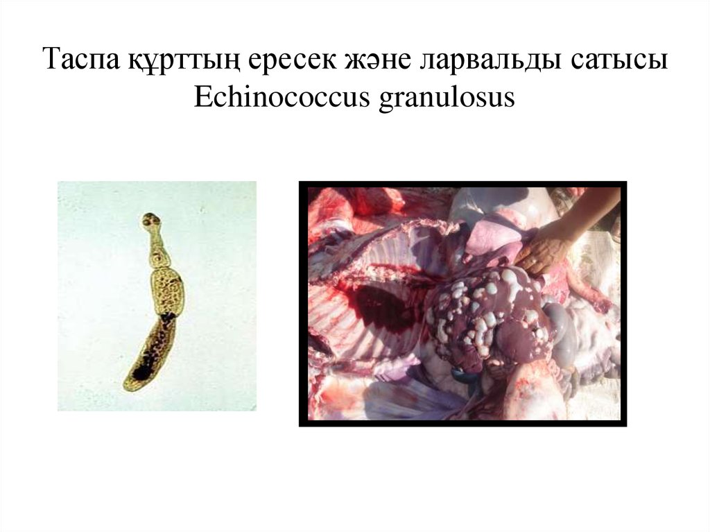 Таспа құрттың ересек және ларвальды сатысы Echinococcus granulosus