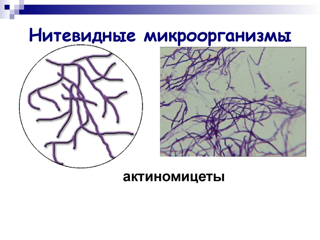 Нитевидные бактерии. Нитчатые формы бактерий актиномицеты. Нитчатые формы бактерий. Нитчатые бактерии — актиномицеты. Актиномицеты микробиология строение.