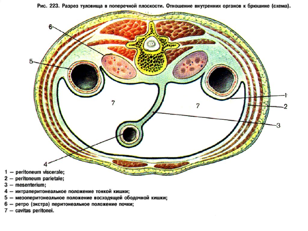 Взаимоотношения органов. Поперечный срез брюшной полости. Горизонтальный срез брюшины. Поперечный распил забрюшинного пространства схема. Разрез брюшины горизонтальный.