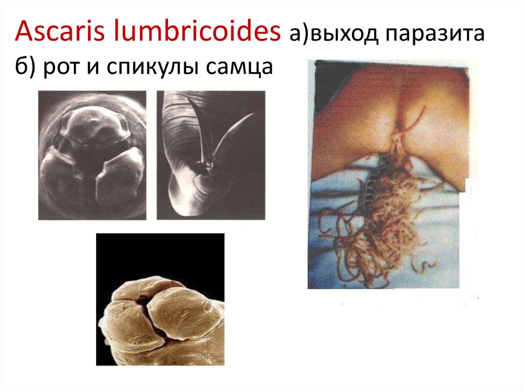 Ascaris lumbricoides a)выход паразита б) рот и спикулы самца
