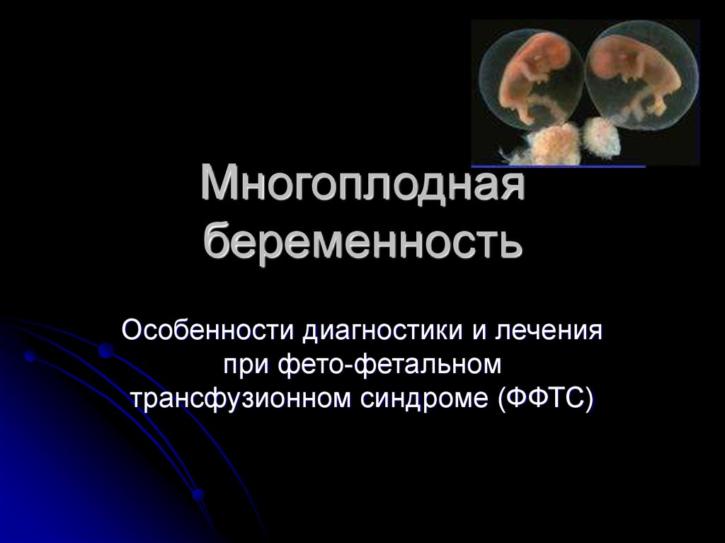 Многоплодная беременность презентация