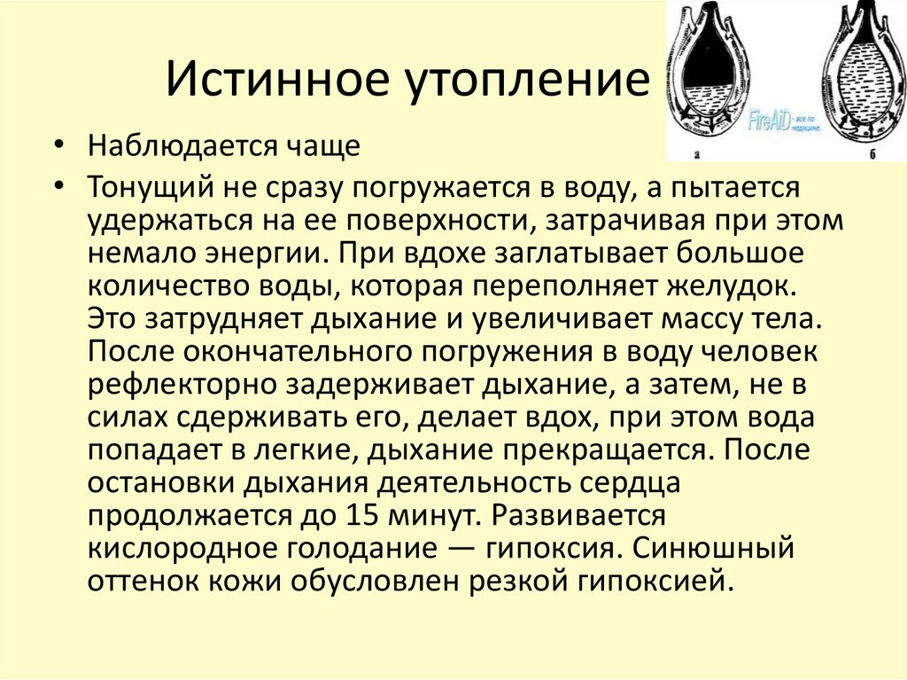 Утопление в пресной воде клинические. Цвет кожи при истинном утоплении. Патогенез утопления в пресной воде. Цвет пены при истинном утоплении в пресной воде. Аспирационный Тип утопления.