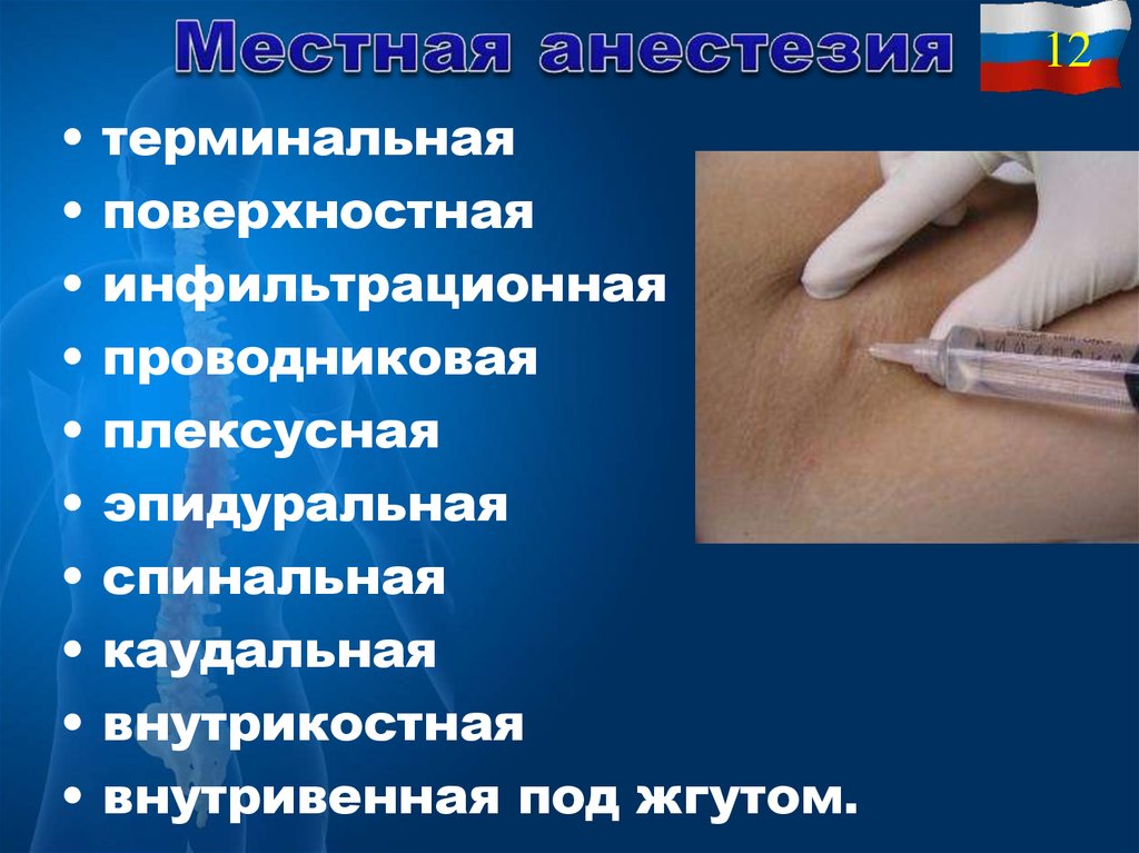 Местная анестезия