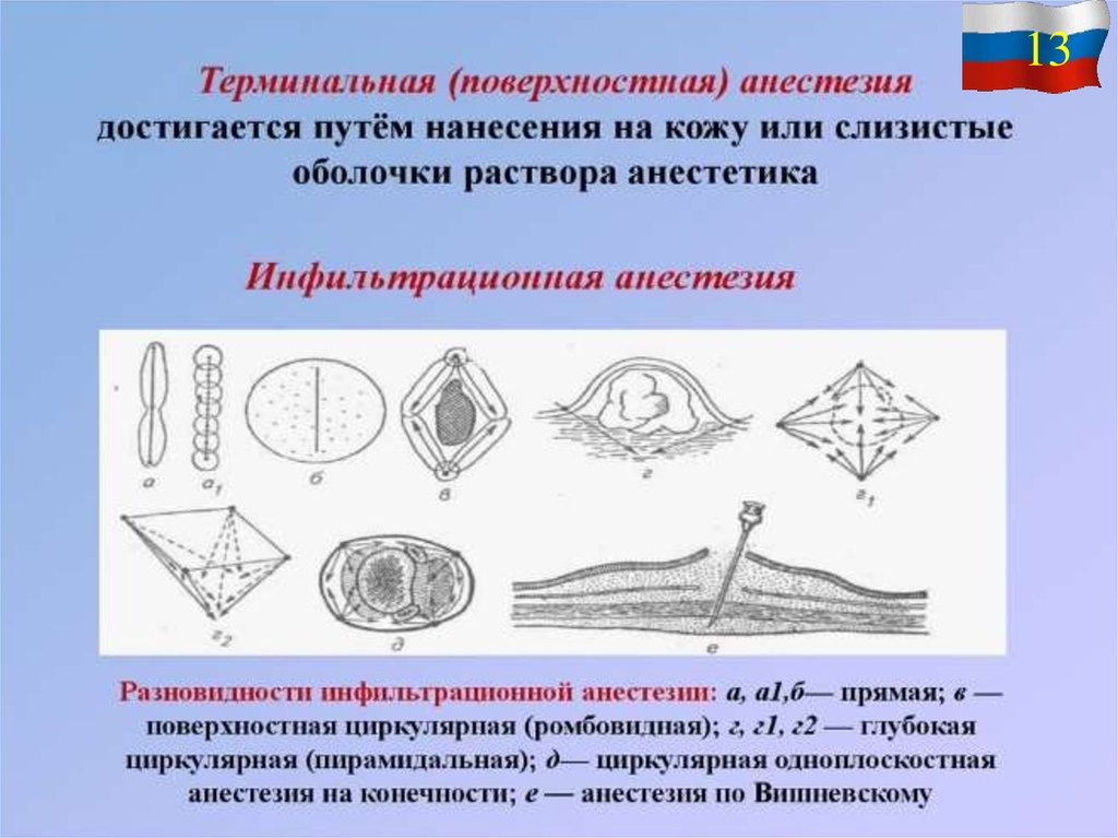 Поверхностная анестезия. Терминальная анестезия. Терминальная анестезия достигается. Ромбовидная анестезия.