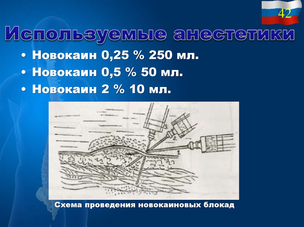 Новокаиновая блокада