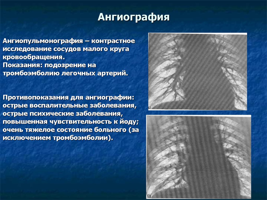 Исследование сосудов. Ангиографическое исследование сосудов. Ангиография сосудов показания. Ангиография показания и противопоказания. Контрастное исследование сосудов.