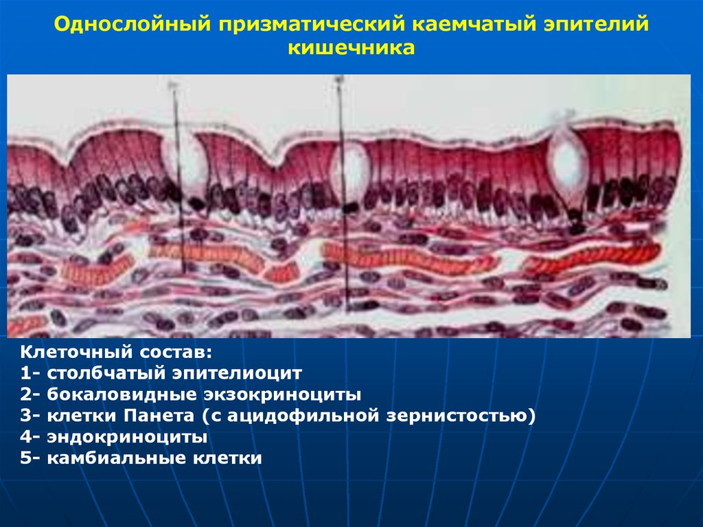 Клетки кишечника. Однослойный однорядный каемчатый эпителий. Однослойный призматический каемчатый эпителий тонкой кишки препарат. Однослойный однорядный столбчатый каемчатый эпителий. Однослойный однорядный призматический железистый эпителий.