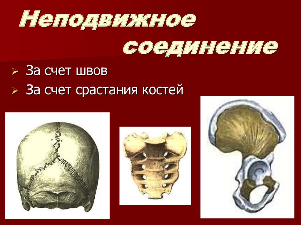 Неподвижно соединены кости. Неподвижные соединения костей скелета. Шов это неподвижное соединение костей. Подвижное полуподвижное и неподвижное соединение костей. Неподвижный Тип соединения костей.