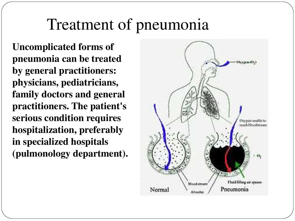 Treatment of pneumonia
