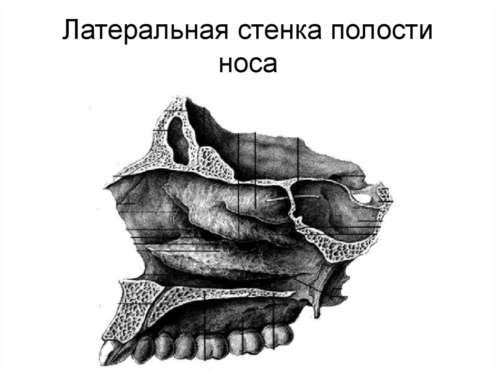 Стенки носа. Медиальная пластинка полости носа. Медиальная стенка носовой полости. Латеральная стенка полости носа анатомия. Латеральной (наружной) стенки полости носа.