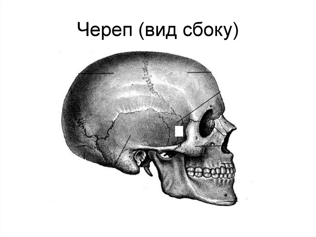 Найти жену черепа картинка правильный ответ