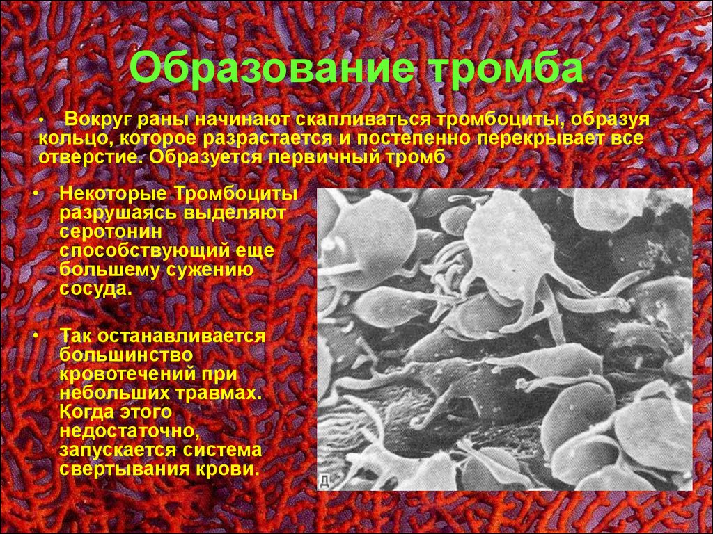 Тромбоциты при кровотечении. Причины и условия образования тромба. Образование тромбоцитарного тромба. Образование красного тромба в сосудах брыжейки лягушки.