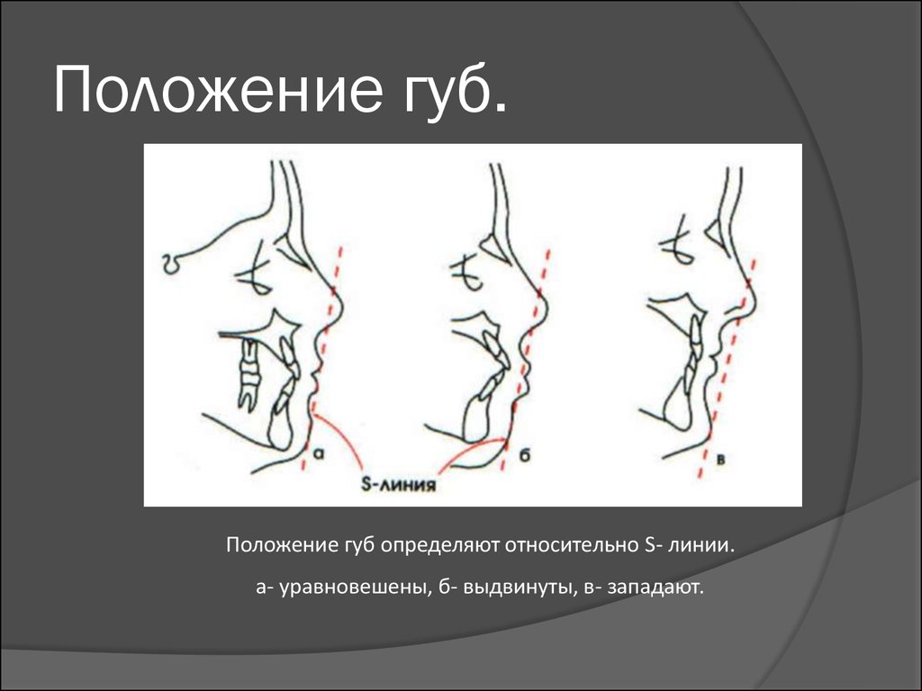 Линия положения. Положение губ. Правильное положение губ. Положение губ относительно линий. Положение губ относительно линии Риккетса.