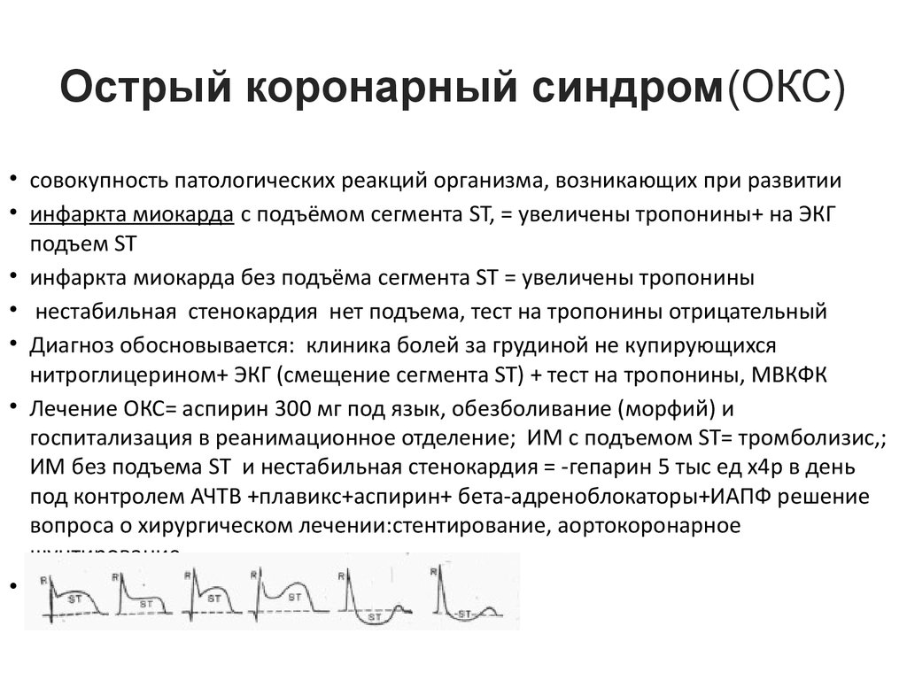 Острая коронарная недостаточность