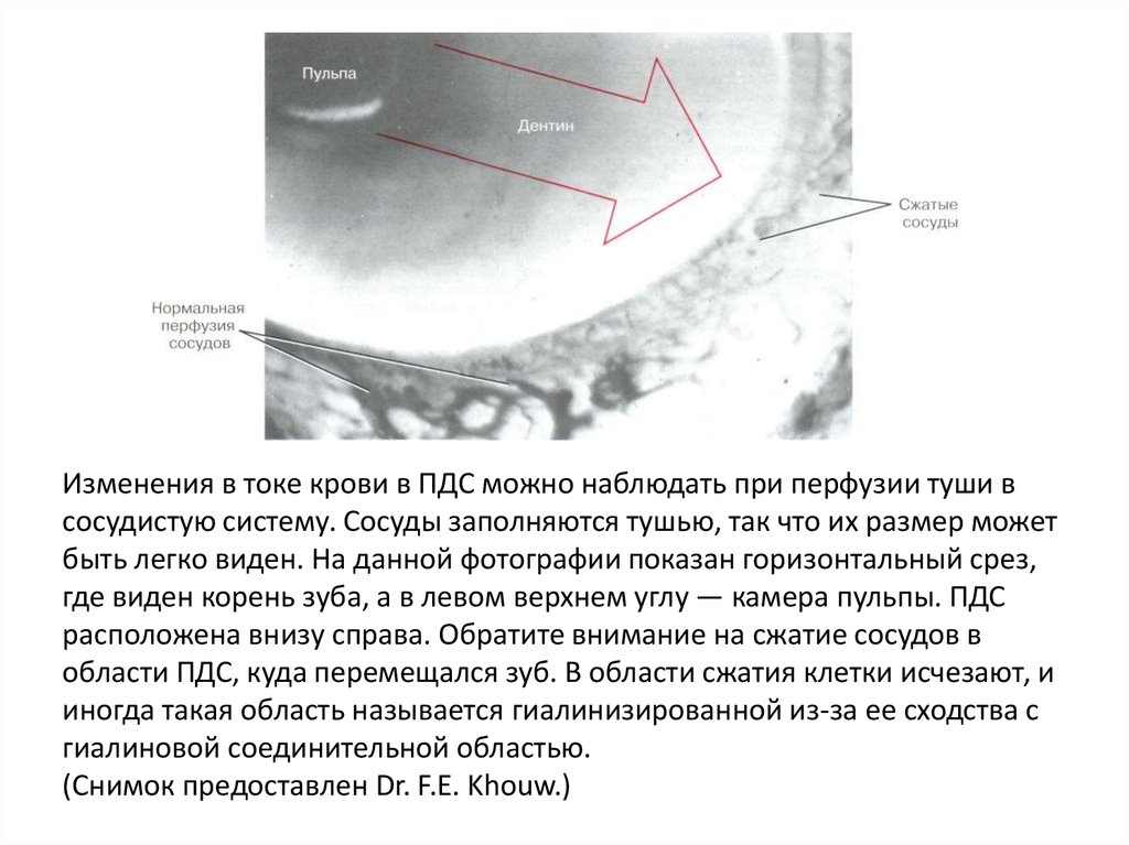 Сжатие сосудов