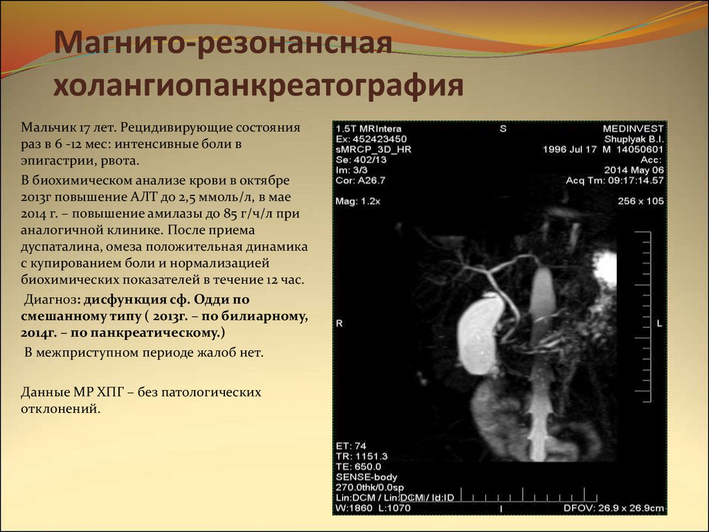 Мрхпг это. Магнитно-резонансная холангиопанкреатография при ЖКБ. Желчекаменная болезнь ЭРХПГ. МРХПГ поджелудочной железы. Заключение магнитно резонансной холангиопанкреатография.