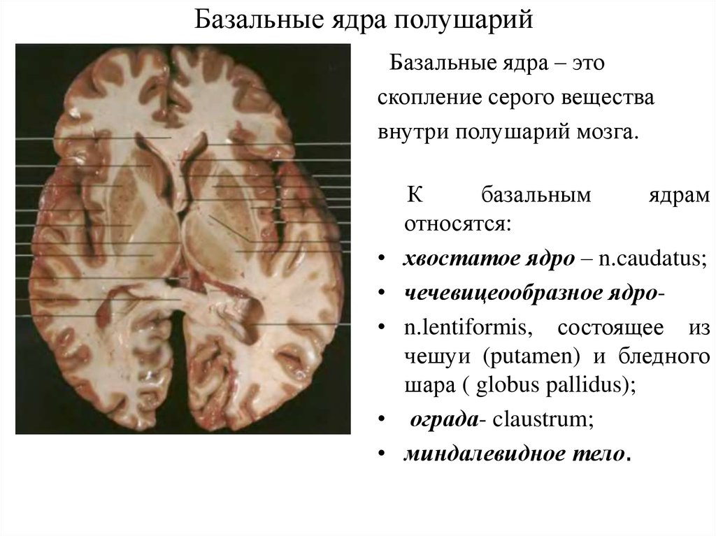 Подкорковые ядра полушарий. Базальные ядра больших полушарий мозга. Базальные ядра головного мозга анатомия. Базальные ядра и белое вещество полушарий большого мозга. Базальные ядра конечного мозга таблица.