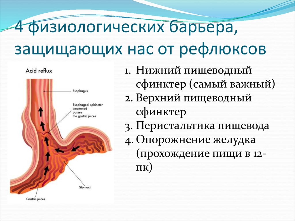 Клапан пищевода