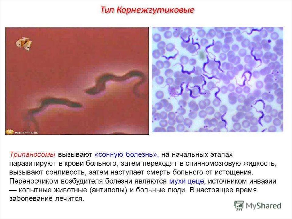 Простейшие вызывают. Сонная болезнь возбудитель трипаносома. Трипаносома вызывает заболевание которое характеризуется. Переносчик трипаносомы. Заболевание трипаносомоз.