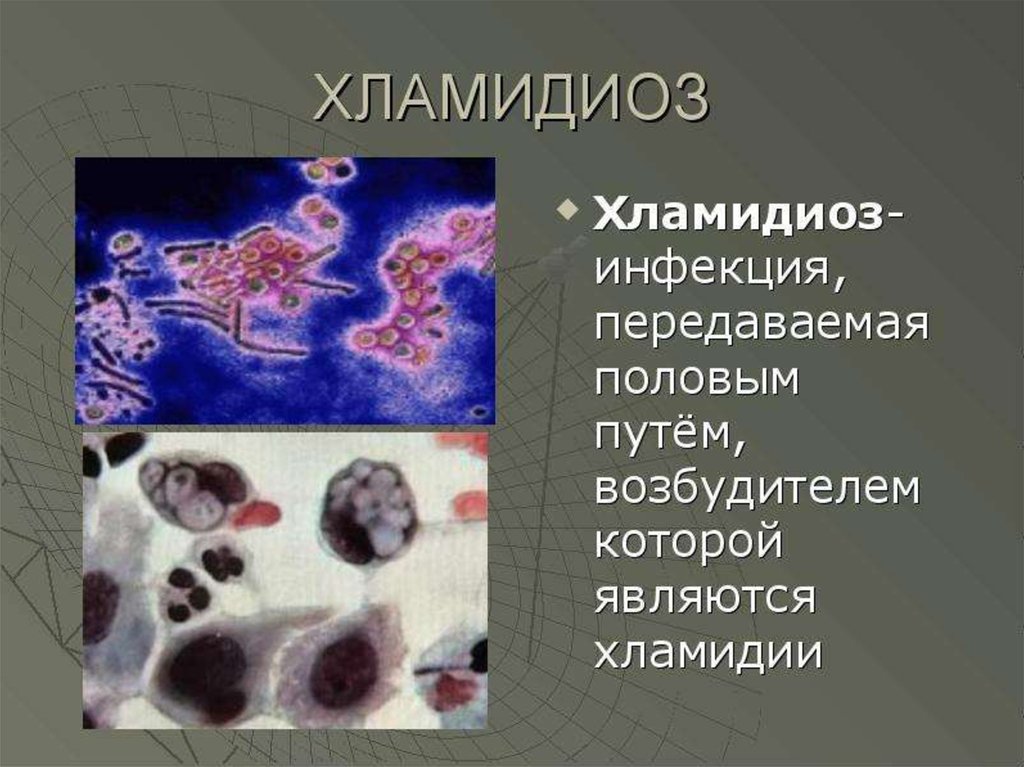 Хламидия в организме. Хламидии урогенитального хламидиоза. Хламидии клетки пораженные. Хламидии клиническая картина. Хламидиоз возбудитель инфекции.
