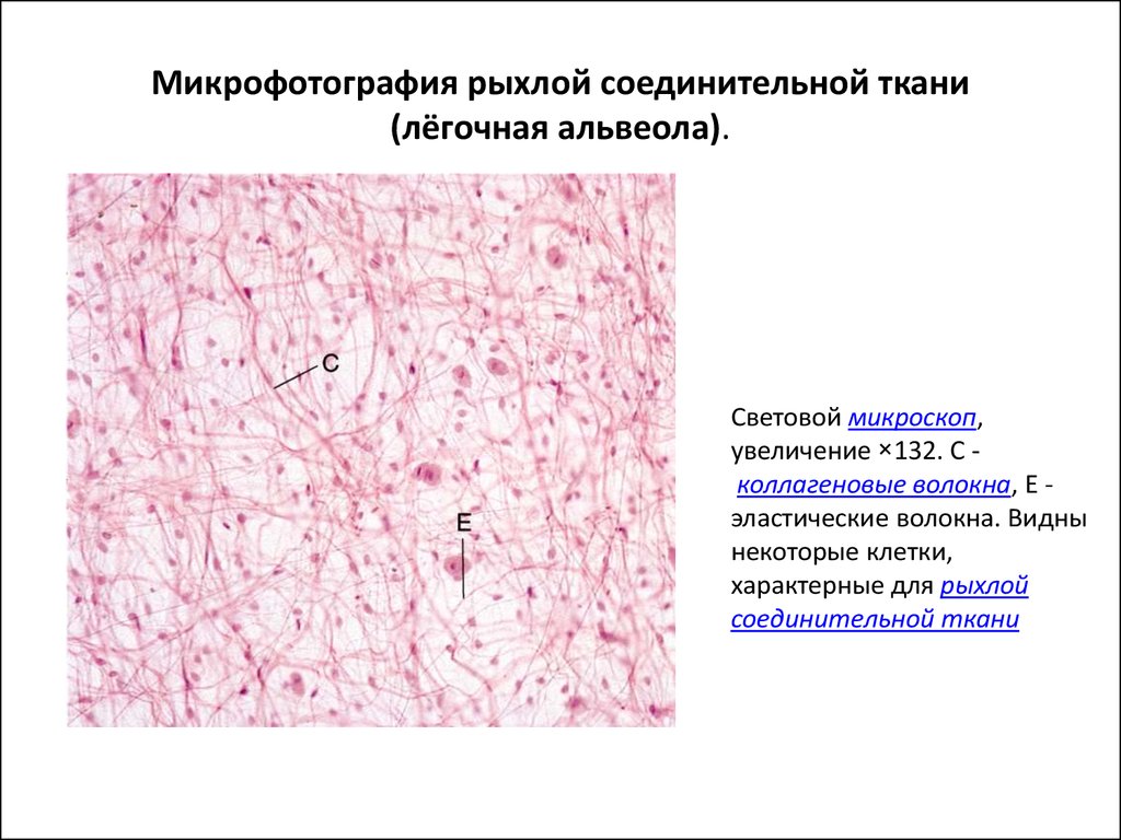 Рыхлая волокнистая соединительная ткань волокна. Микрофотографии соединительной ткани. Микрофотография рыхлой соединительной ткани. Соединительная ткань микрофото. Коллагеновые волокна рыхлой соединительной ткани.
