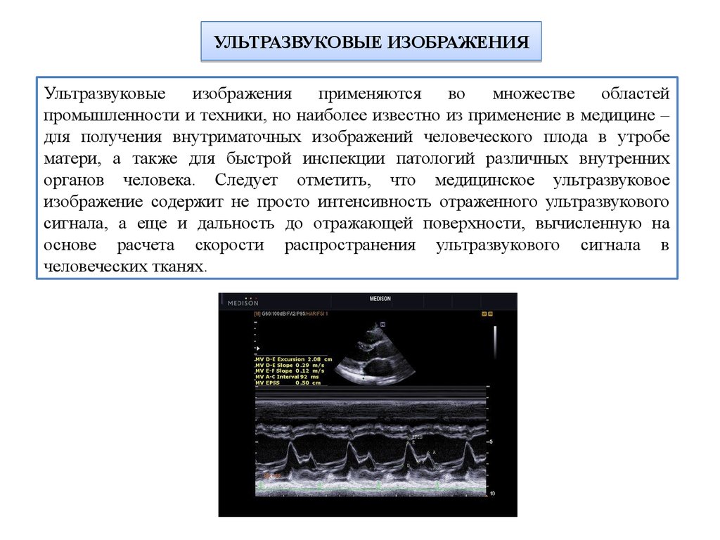 Ультразвук картинки для презентации