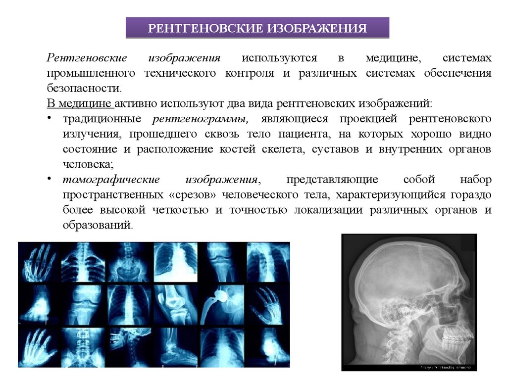 Единица цифрового изображения на рентгенограмме это