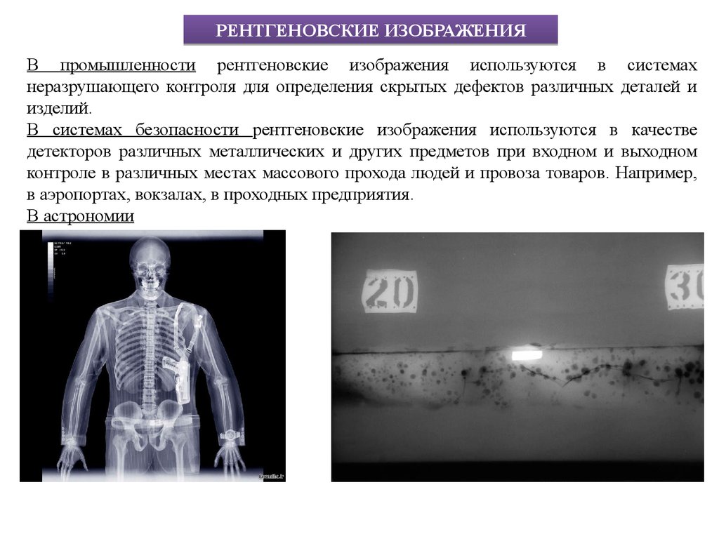 Характеристика изображений на рентгенограммах